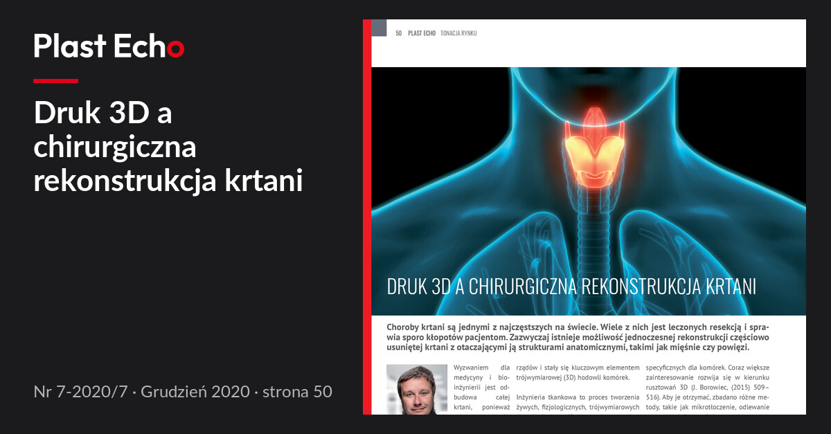 Druk 3D a chirurgiczna rekonstrukcja krtani | Plast Echo 7-2020/7, Grudzień 2020, s. 50