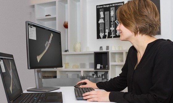 Nowe zastosowanie druku 3D w chirurgii dziecięcej