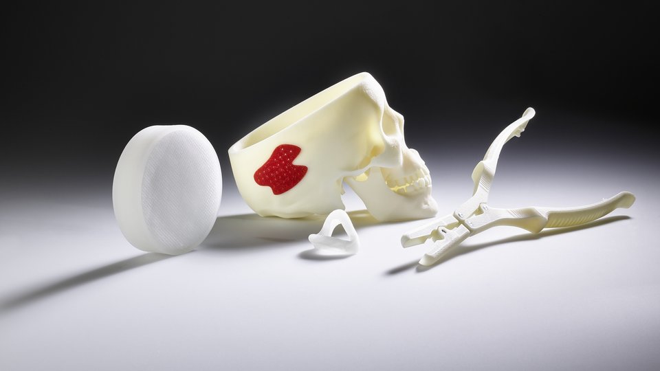 Additive manufacturing in medical technology