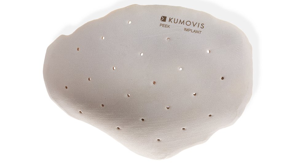 Kumovis to show new end-to-end workflow for medical 3D printing