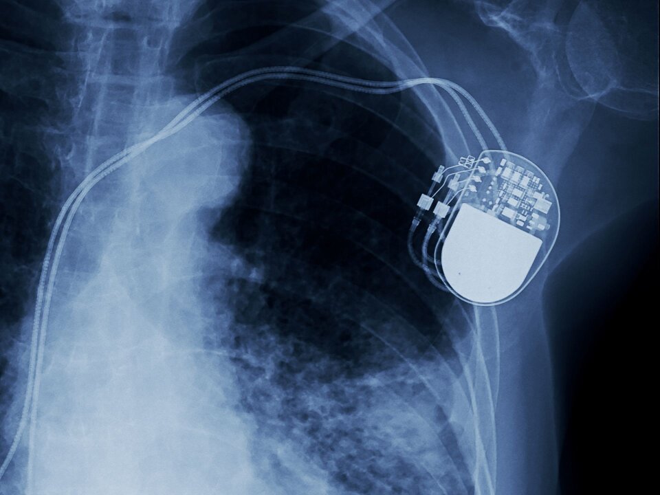 Niestandardowe zespoły Trelleborg Medical Solutions do zastosowań kardiologicznych