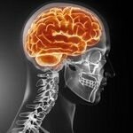 Plastic skulls to treat head injuries