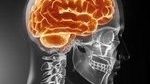 Plastic skulls to treat h